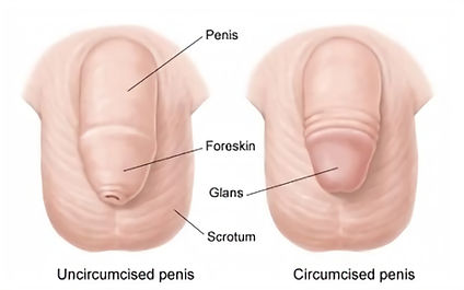 circumcision before after