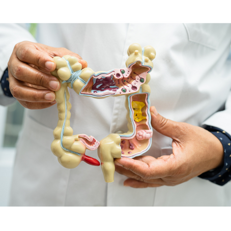 Essential Guide: Spotting Colitis Symptoms and Finding the Best Treatment Options