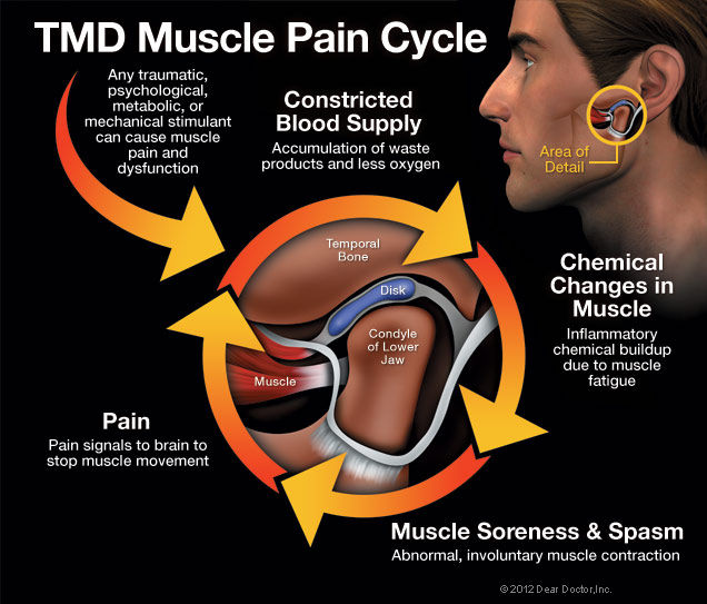 No More Clicking or Popping! What You Can Do To Relieve Your Jaw Pain!