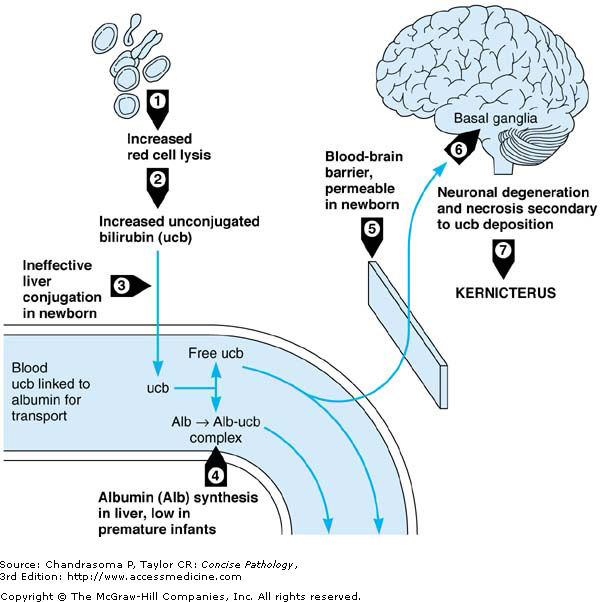 Bilirubin and the blood brain barrier 1.