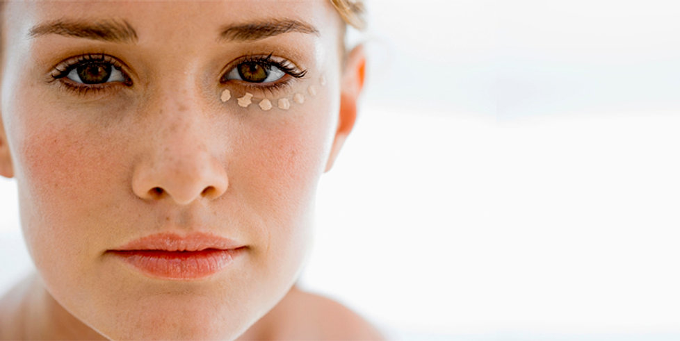 Jessner Peel Recovery