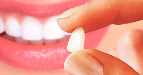 Lentes de Contato Ceramica