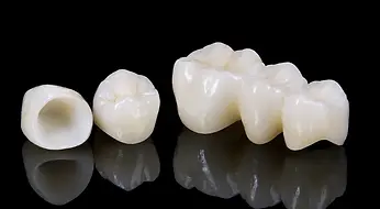 Zirconia dental crowns and bridges for high-strength smile restoration