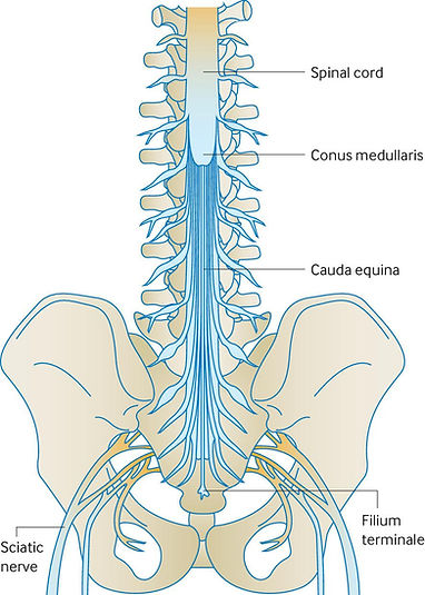 Disc Bulge Treatment