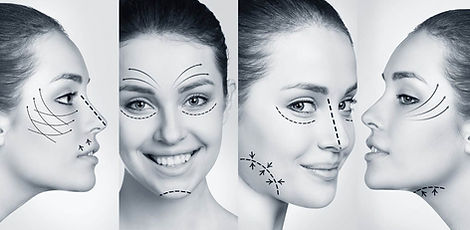 youthful woman with diagrams drawn on face to show ares where the Jet Plasma Pen with lift the skin and tighten it