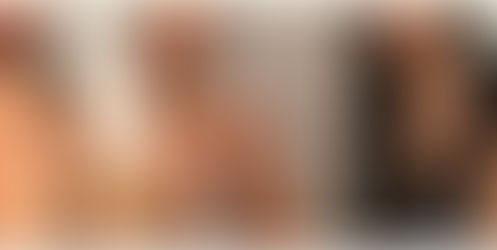 Las nuevas fotos de la pericia médica de Barbie Vélez