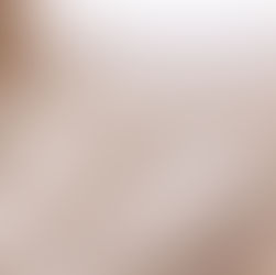 SLEEP ON A CLOUD WITH MICROCLOUD