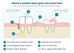 Back Tooth Hurting and Gum Swollen? What It Usually Means and What to Do