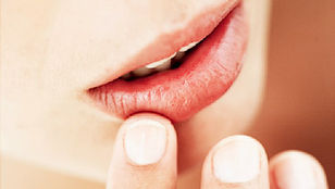 Mouth Sores