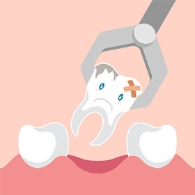 Dental Extractions