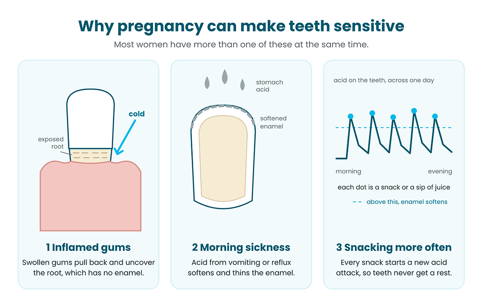 Diagram of three reasons teeth become sensitive during pregnancy: inflamed gums exposing the root, stomach acid softening the enamel, and frequent snacking