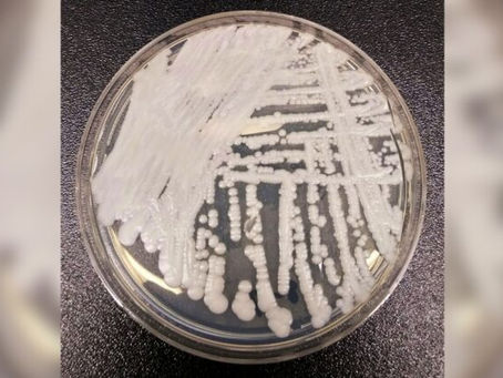 CDC adverte sobre infecção fúngica perigosa que se espalha pelos EUA a "taxa alarmante"