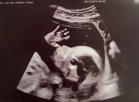 Congenital Heart Defect Awareness Week: Diagnosis Day