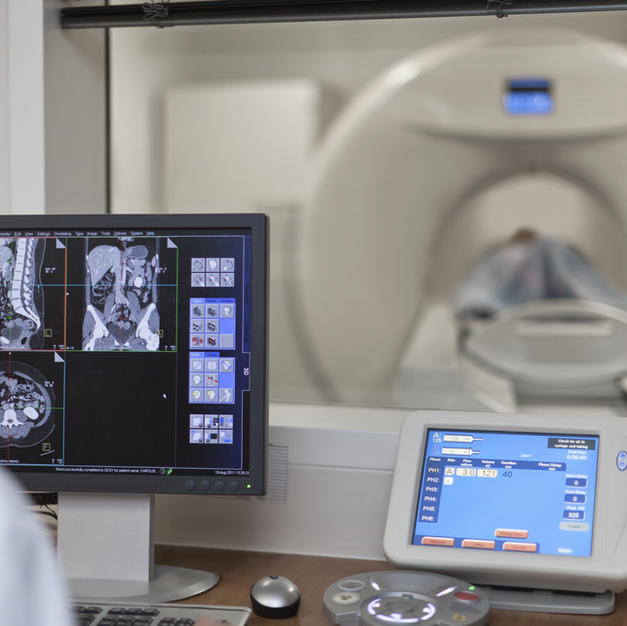 4D-CT