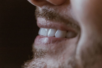 Lentes de Contato Dental