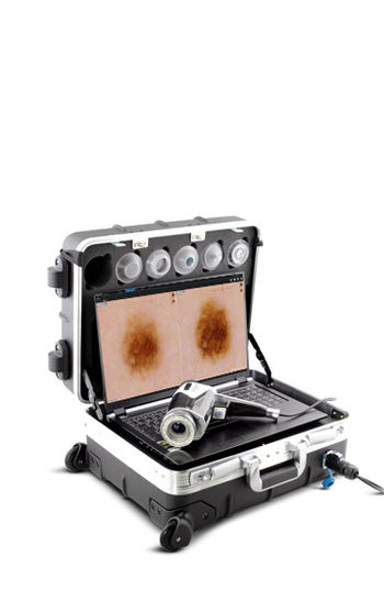 vidix-portable-unit.jpg