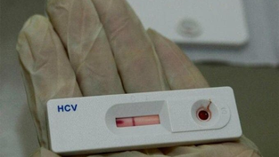 Amargosa registra 4 casos positivos de sífilis durante o São João, aponta Sesab