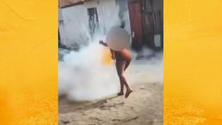 Mulher fica gravemente ferida após ter rosto atingido por espada junina em Cruz das Almas