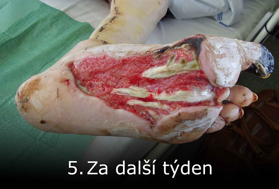 ZA DALŠÍ TÝDEN