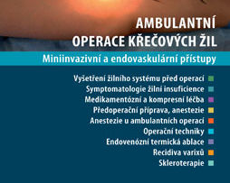 Ambulantní operace křečových žil