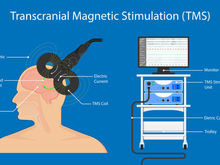 TMS now covered under Medicare for Treatment resistant depression