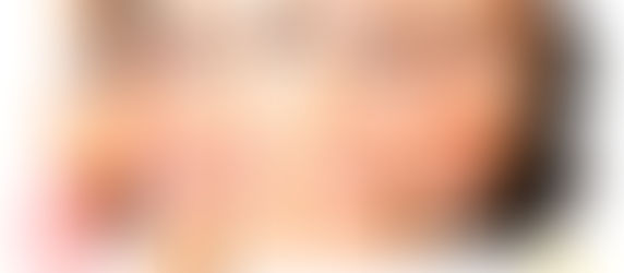 ¿Sabes cuál es tu fototipo?