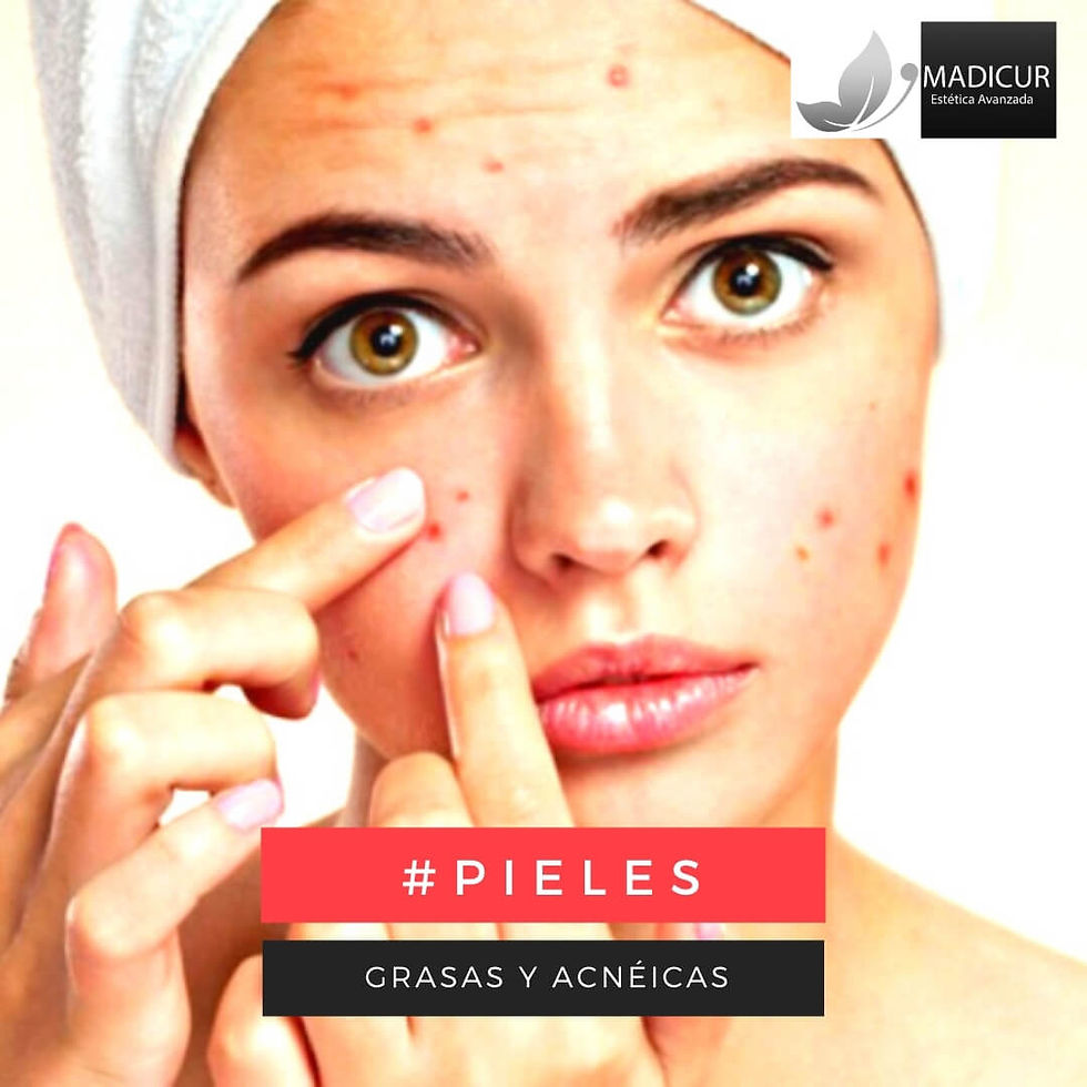 PIEL GRASA Y PIEL ACNÉICA