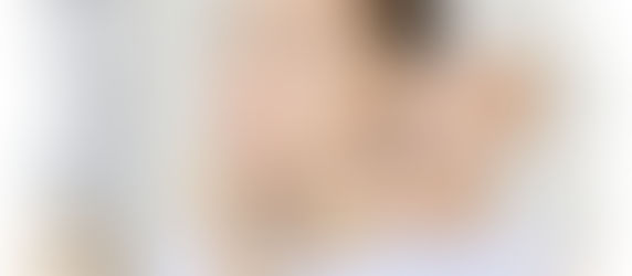 Jerez: manchas en la piel