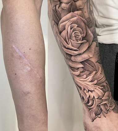 Scar camouflage tattoo transformation