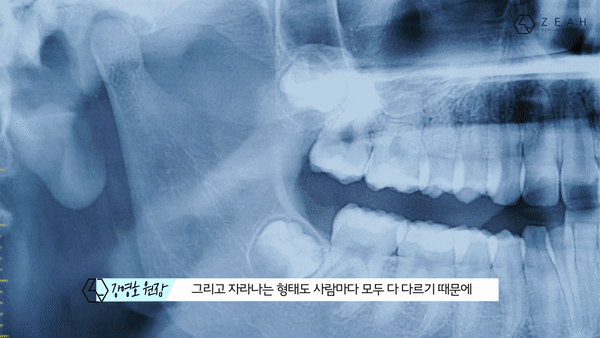 그래픽인서트사례01.gif