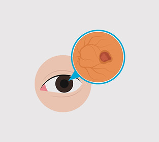 ดีไซน์ที่ยังไม่ได้ตั้งชื่อ (3)_edited.jp