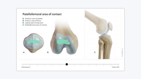 Patellofemoral area of contact