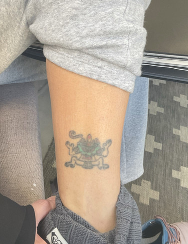 An old and faded tattoo that no longer speaks to the client