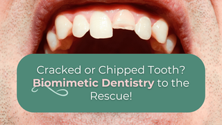 The Best Solution for Chipped or Cracked Teeth Using Biomimetic Dentistry