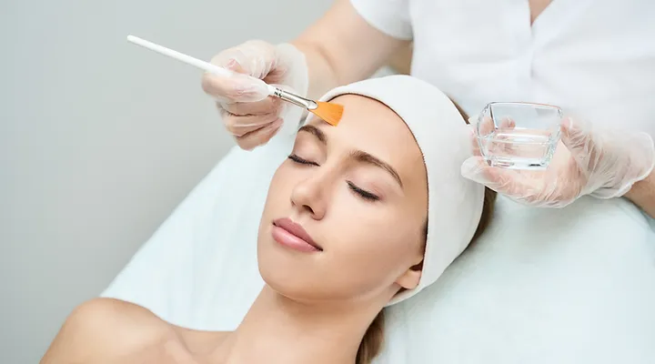 chemical peel treatment