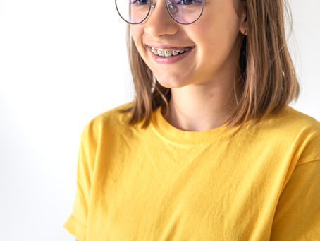 Lightweight Eyeglass Frames Trending in London, Ontario – 2026 Style Guide