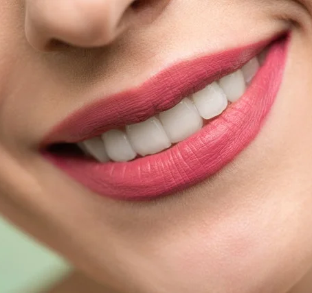 Teeth Whitening- Everything you need to know