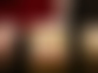 Dental Implants- Everything You Need to Know