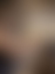 When IBE Isn't the Right Fit — What Happens Next?