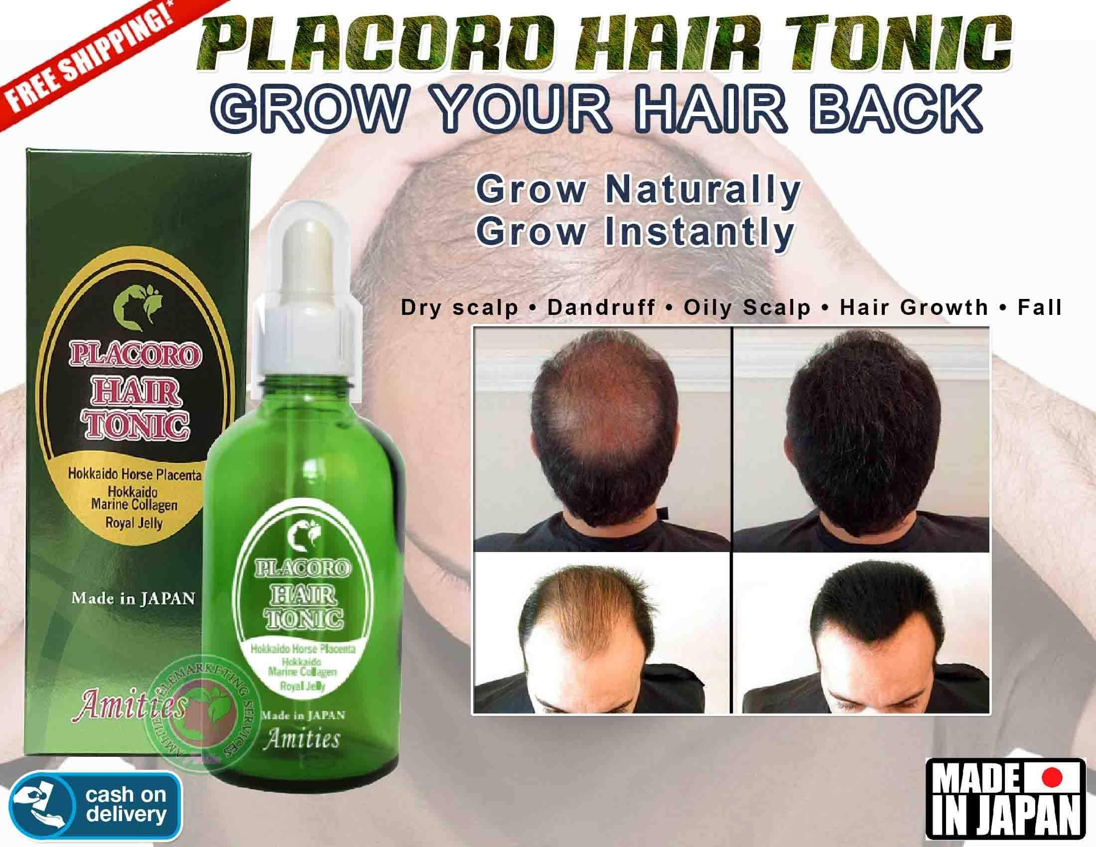 PLACORO HAIR TONIC GROWER