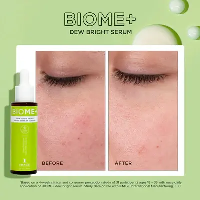 Thumbnail: BIOME+ Dew Bright Serum