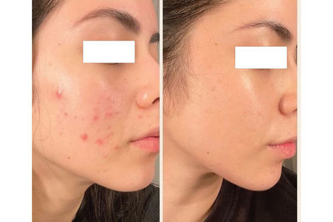 Skincare Treatment Showcase