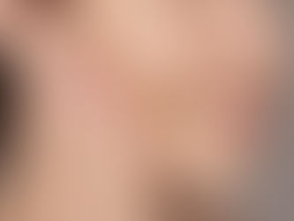 Causes of Skin Pigmentation and How to Treat It in Islamabad