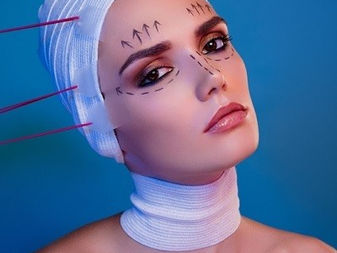 Revitalize Your Look: Thread Lift Services in Islamabad