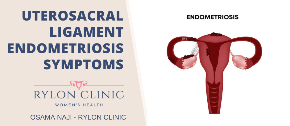 Uterosacral Ligament Endometriosis Symptoms