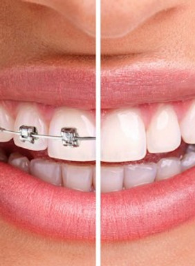 Familydent - Ortodoncia