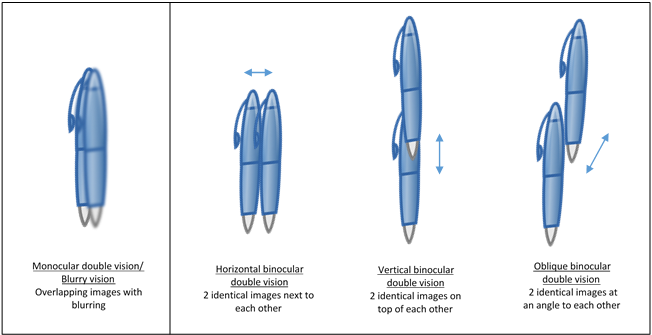 Common Eye Symptoms Double Vision common-eye-symptoms-double-vision