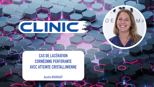 CLINIC - Cas de lacération cornéenne perforante avec atteinte cristallinienne