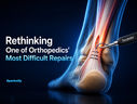 The Startup Rethinking One of Orthopedics’ Most Difficult Repairs