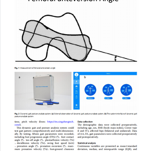 #مشاركة_الورقة_البحثية#تأثير وضع مفصل الورك الاصطناعي على المشية بعد الجراحة في مرضى هشاشة العظام الوركية المصحوبة بأعراض ثانوية لخلل تنسج الورك بعد عملية استبدال مفصل الورك الكلي الأولي